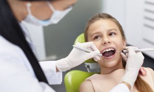 Серебрение зубов