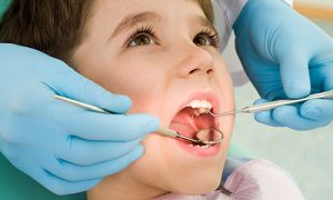 Лечение кариеса коренных зубов у детей