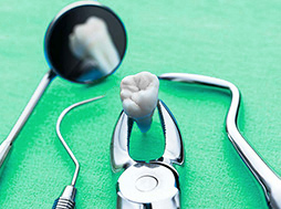 Удаление зуба в стоматологии в Кудрово