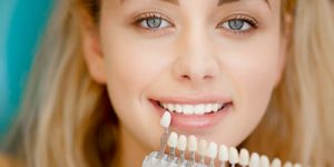 Восстановление зубов винирами